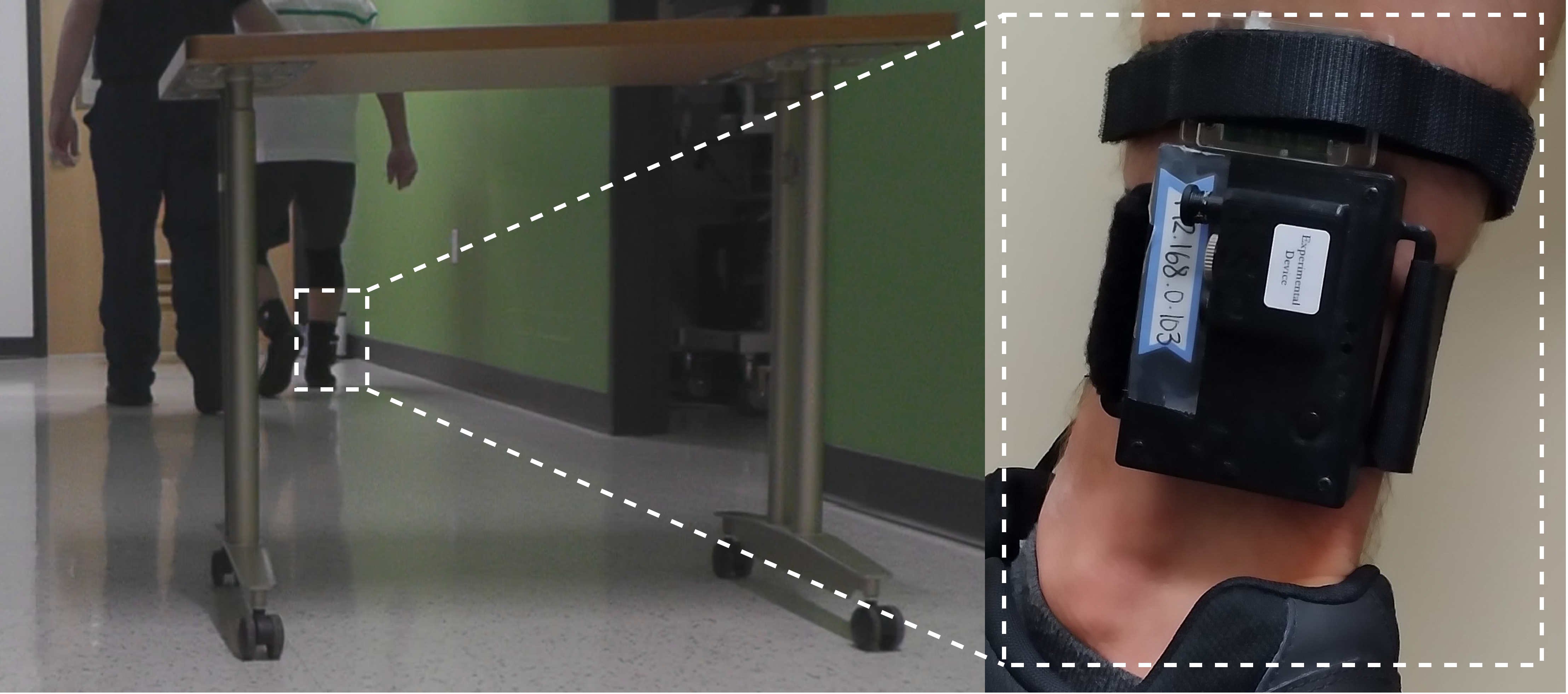Placement of the wearable sensor for Gait-Guard. (Image courtesy of Gang Zhou)